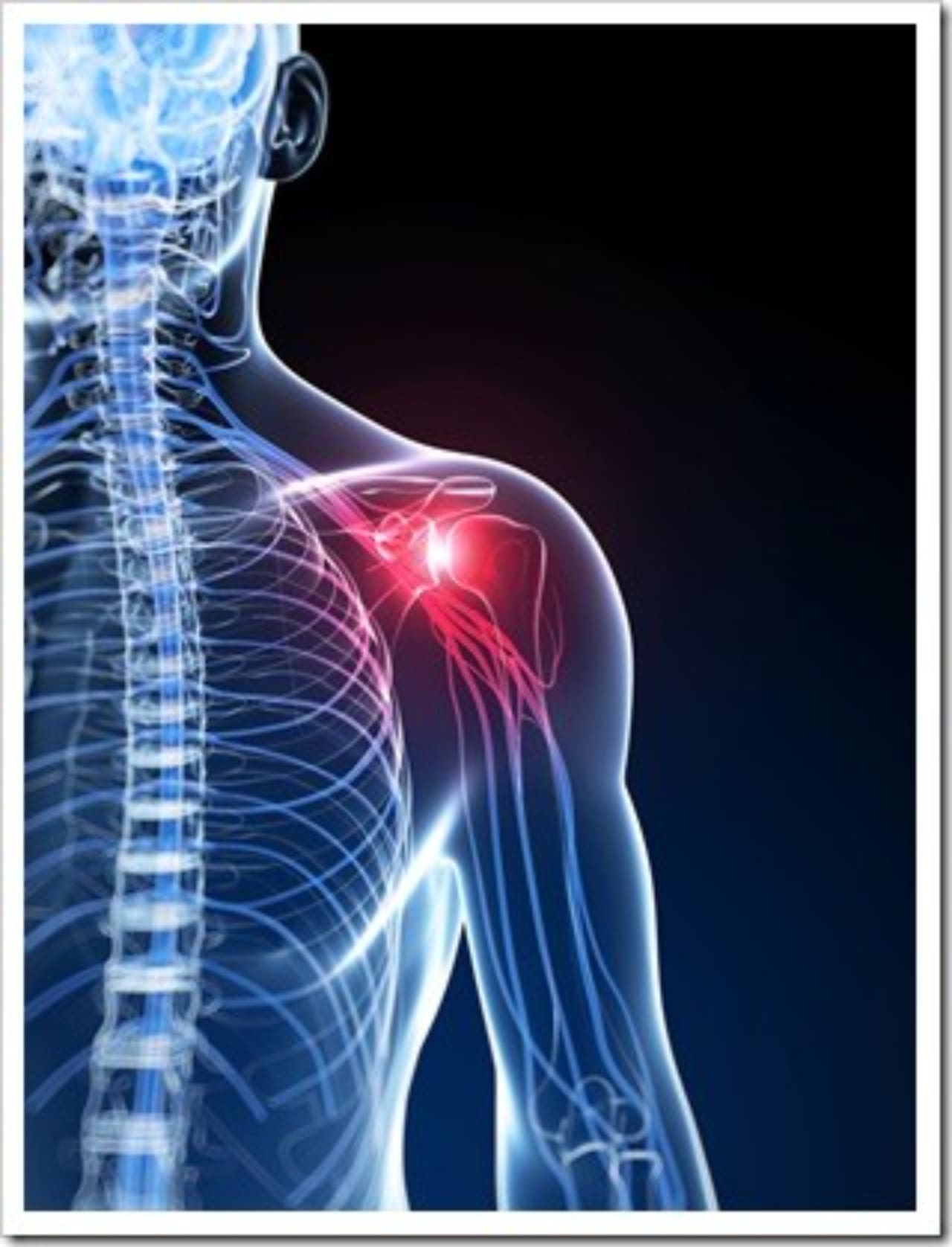 Frozen Shoulder Clinton MS Neck Pain
