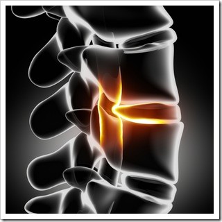 Slipped Disc Clinton MS