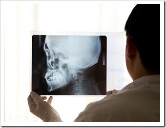 Clinton TMJ Jaw Pain Treatment